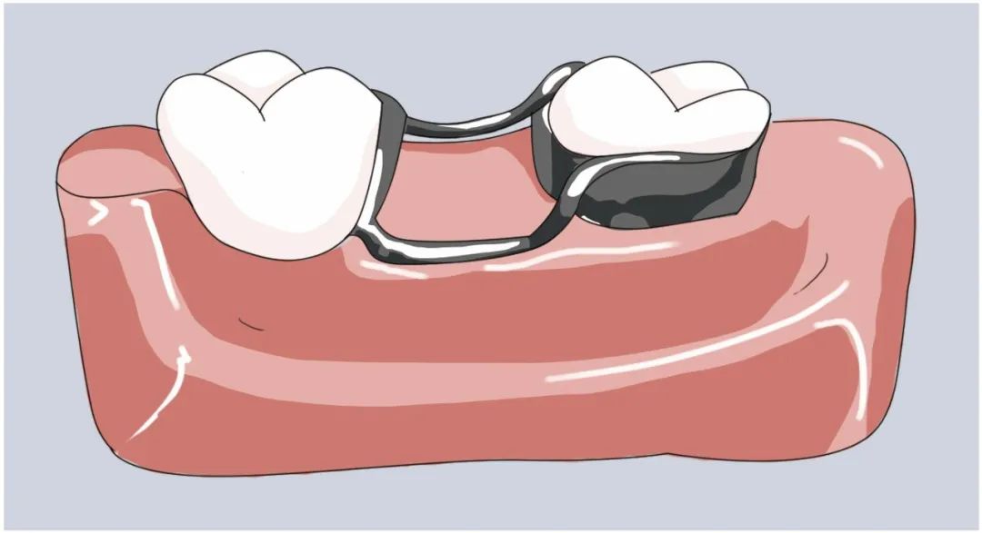 许跃正畸案例,正畸教授许跃案例