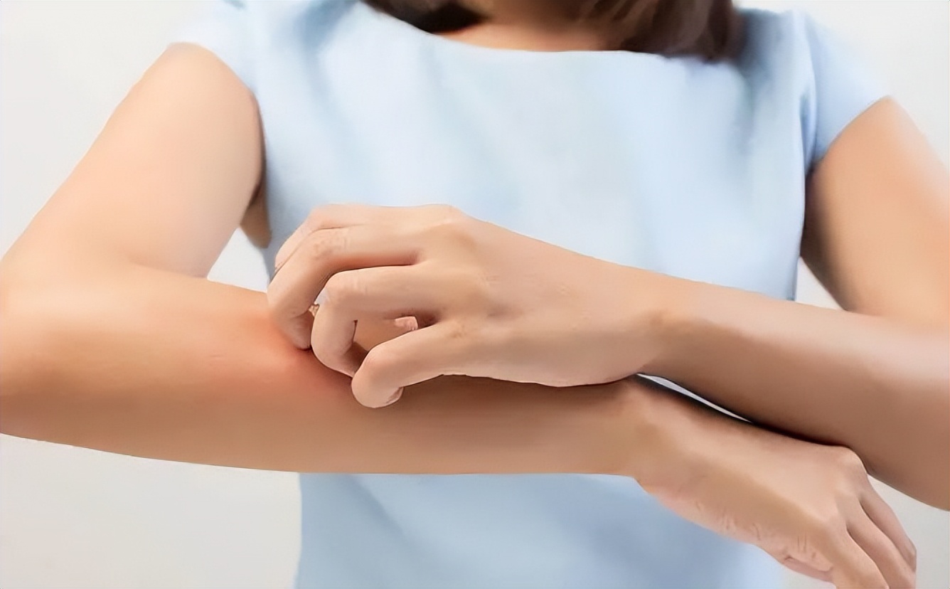 一到晚上皮肤就瘙痒荨麻疹,荨麻疹一到晚上就全身痒怎么调理