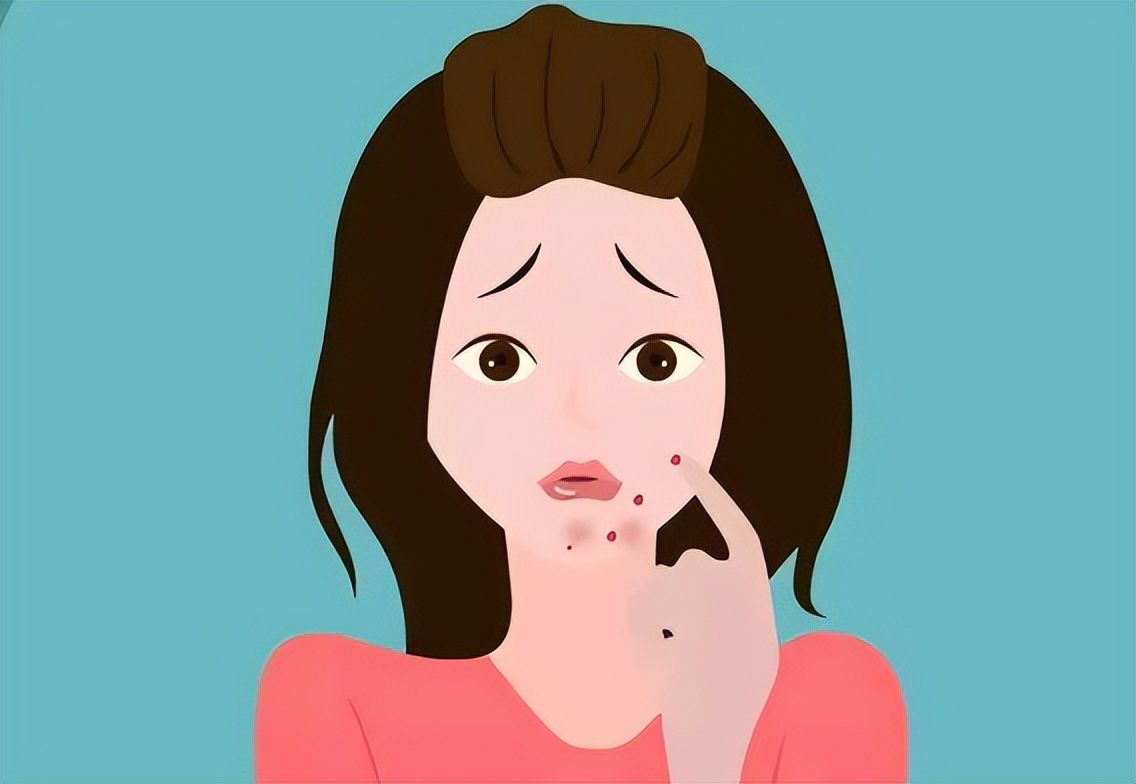 *疮痤**疤痕疙瘩应该怎么去除？*疮痤**疤痕疙瘩怎么根治？