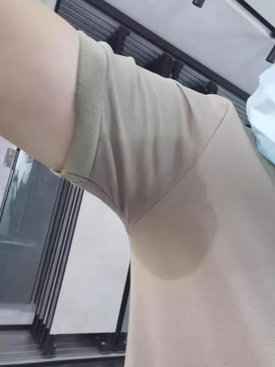 十年狐臭一招改善,狐臭治疗经验分享