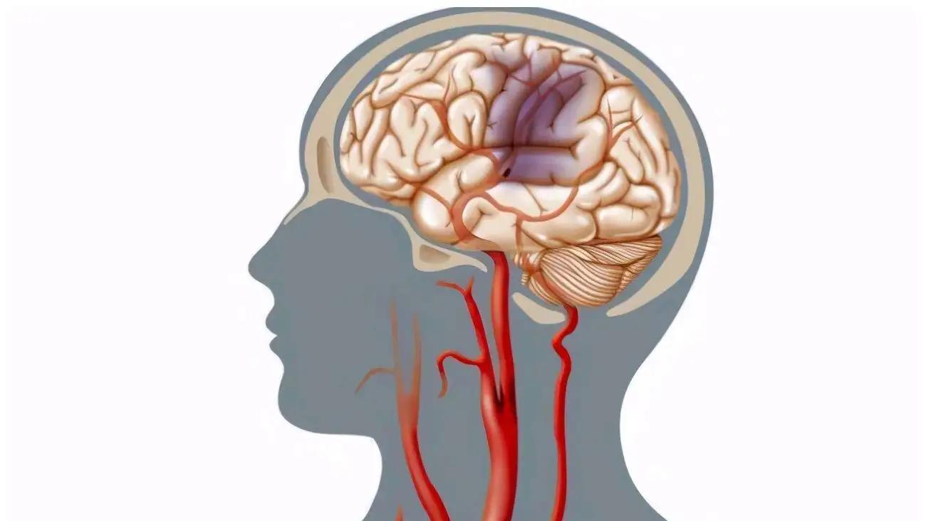 老年人睡不着脑供血不足怎么回事,老年人患有脑供血不足可以针灸吗