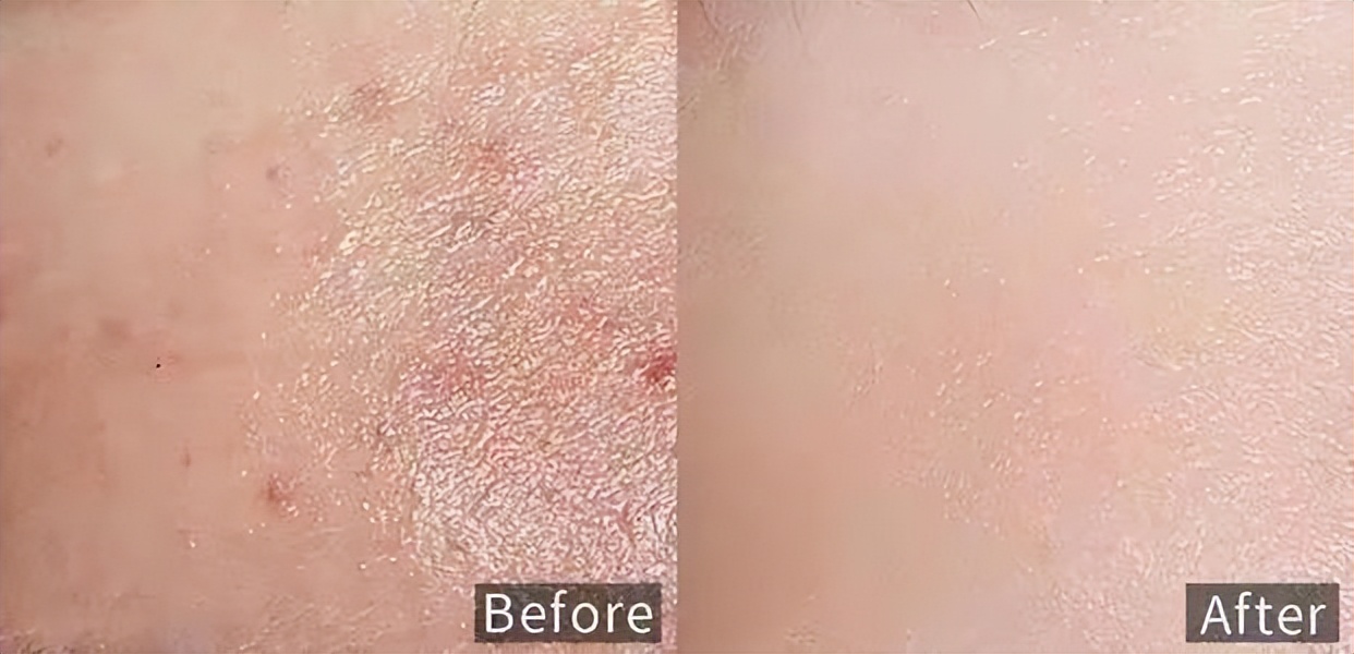 成分学科普,成分科普创意