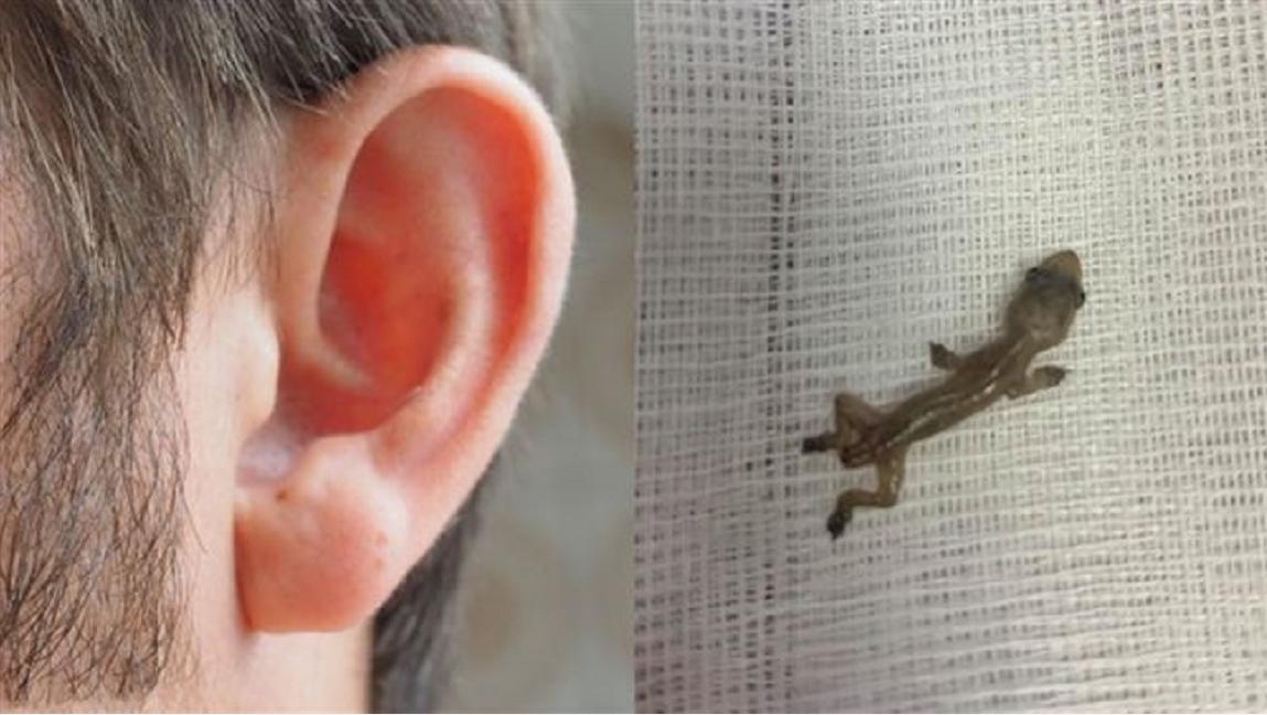 为什么壁虎也在五毒之中,壁虎为啥是五毒