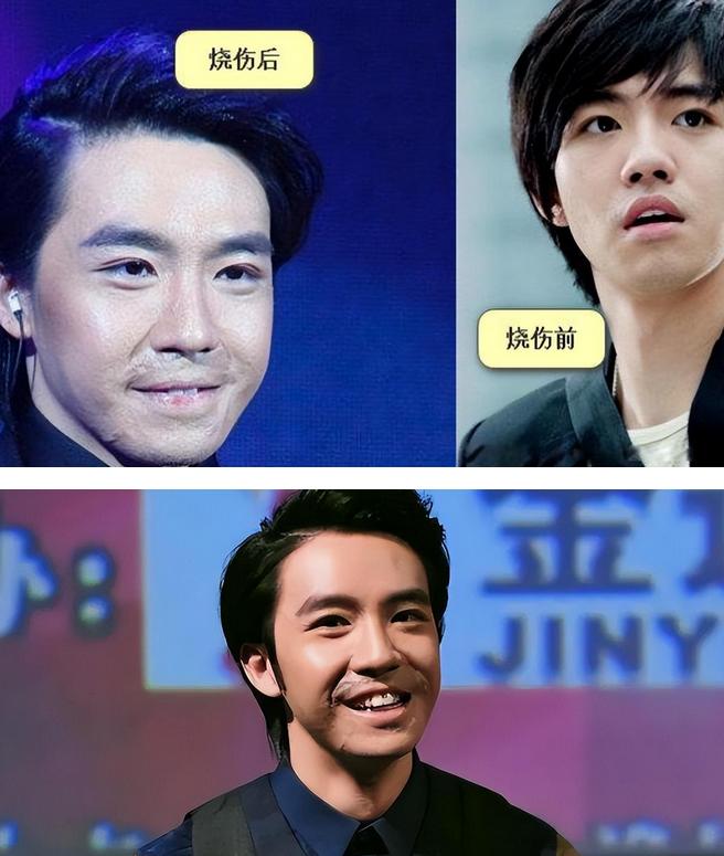 俞灏明从青涩国民弟弟到成熟,俞灏明被毁容偷偷抹眼泪