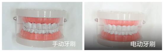 电动牙刷真的有用吗怎么用,电动牙刷真的有用吗可以用多久