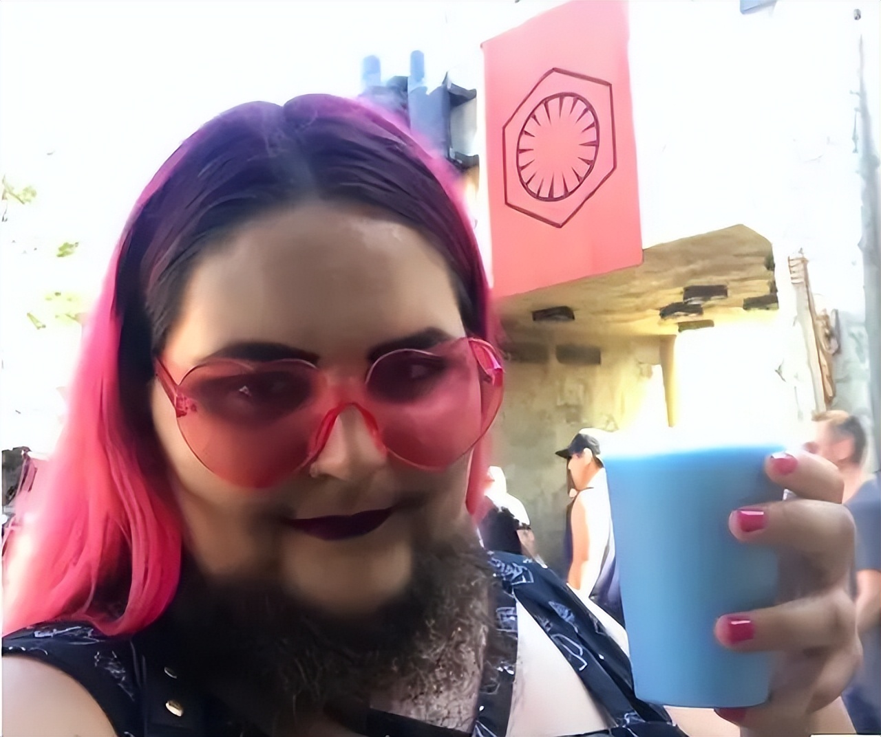 13岁的小女孩长胡子正常吗,13岁女孩长很多胡子