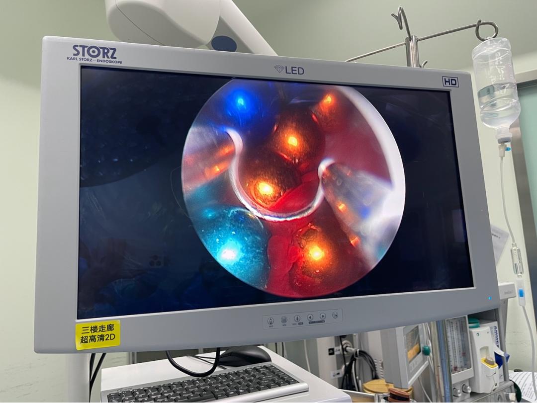 14岁男孩,把30颗这东西塞进尿道!医生都傻眼了