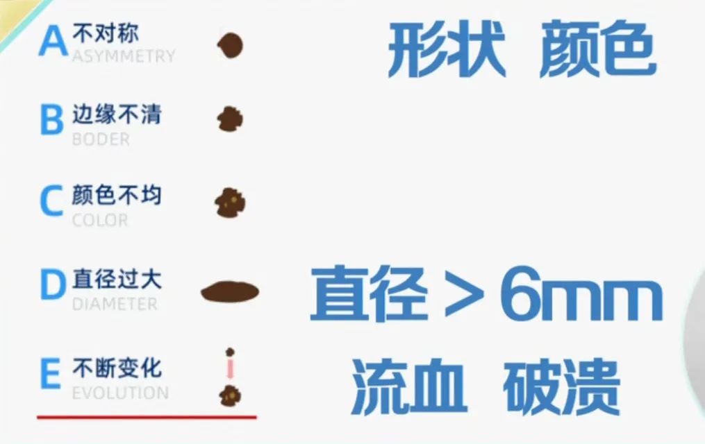 一旦发现自己身上有这4个征兆,肝癌有痣的前兆