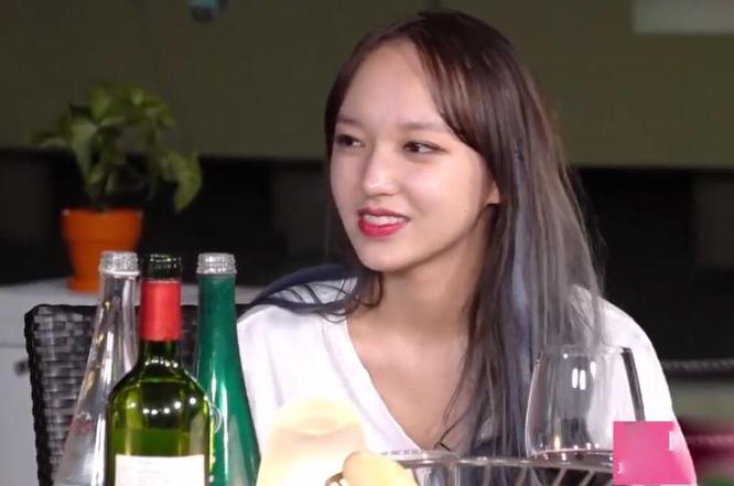 明星逃不过的脱发,明星也秃头还戴假发片