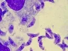 猫咪疾病会传染人吗,猫咪常见容易传染给人的疾病