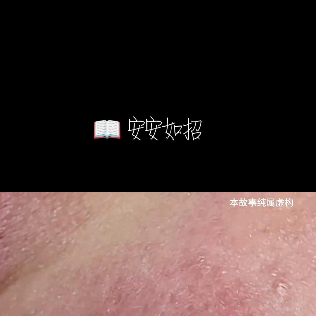 📖安安如招后续知乎#粉刺针的正确使用方法