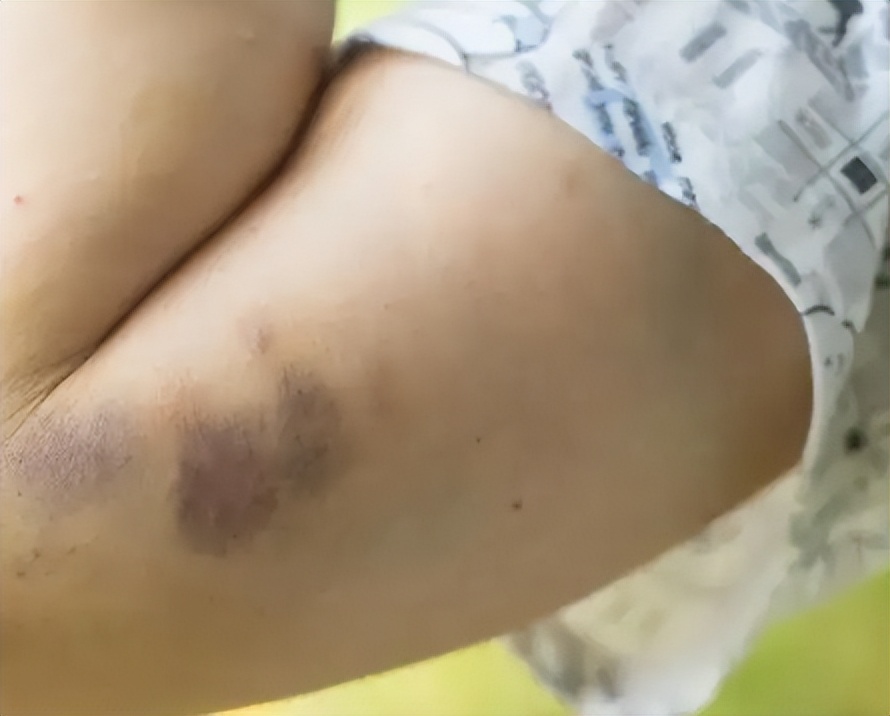 筋膜枪哪个品牌比较好评测,筋膜枪哪个品牌最好用