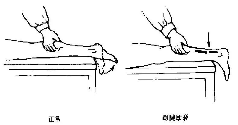 常见运动损伤及处理方法教案,体育课常见运动损伤及处理
