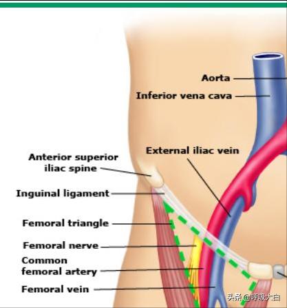 深静脉穿刺股静脉步骤,深静脉穿刺置管术视频教程