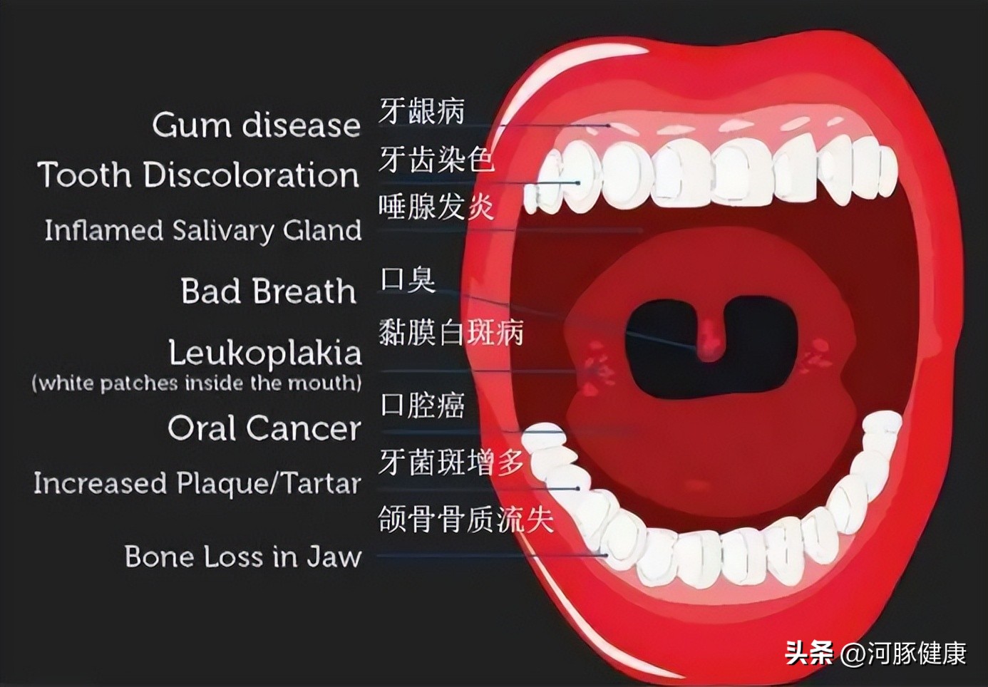 长期口腔溃疡一直不愈是癌吗,口腔溃疡不管它一般几天就能自愈