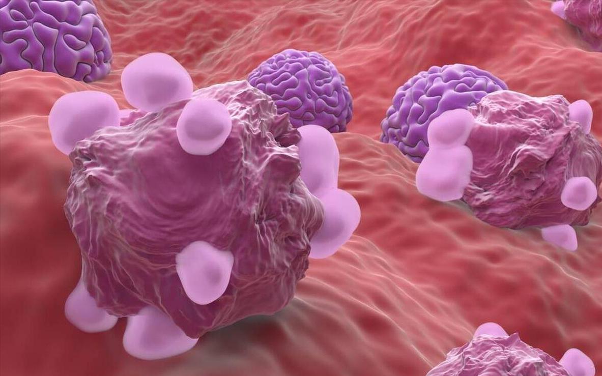 感觉妇科湿湿的是怎么回事,年轻女人妇科干涩要怎么内调