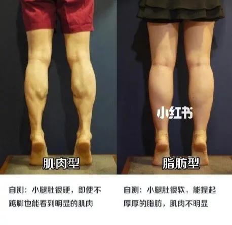 小腿粗外翻怎么改善,改善小腿粗的方法