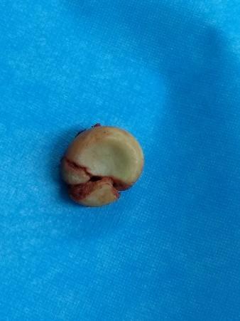 优秀！重庆两江新区中医院年度十佳技术出炉！