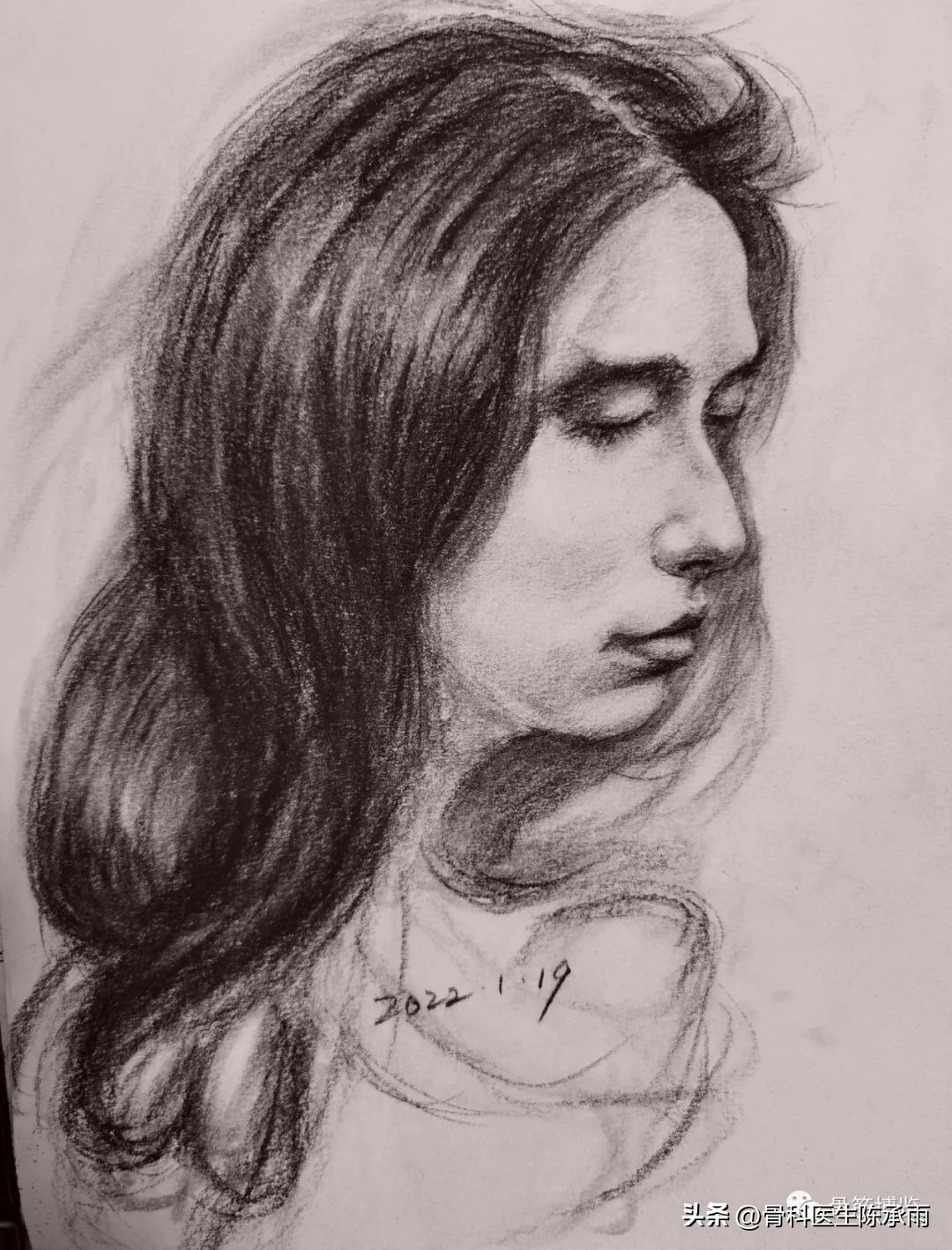 腰椎滑脱椎管狭窄手术后遗症,腰椎间盘突出椎管狭窄的手术