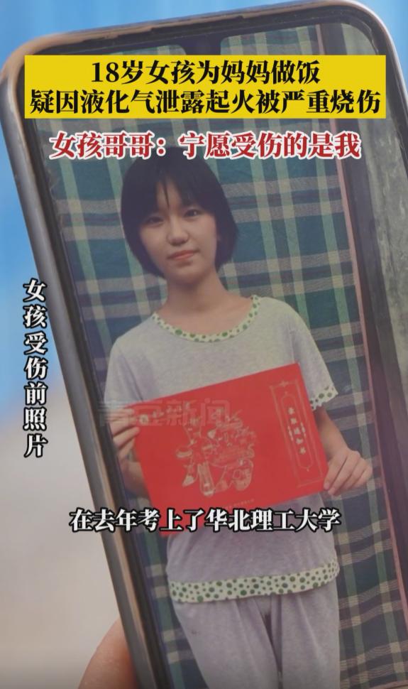 18岁女孩做饭被严重烧伤捐款,高一16岁女孩被烧伤
