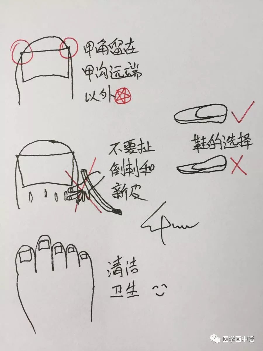 得了甲沟炎如何快速处理,甲沟炎怎么办教你一招解决