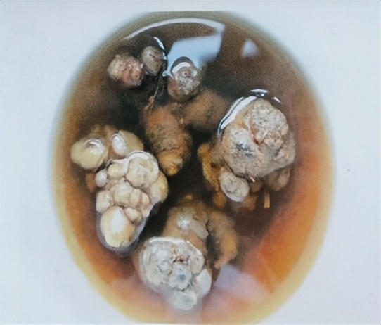 三七和金不换是一样的吗,金不换和三七是同一种中药吗