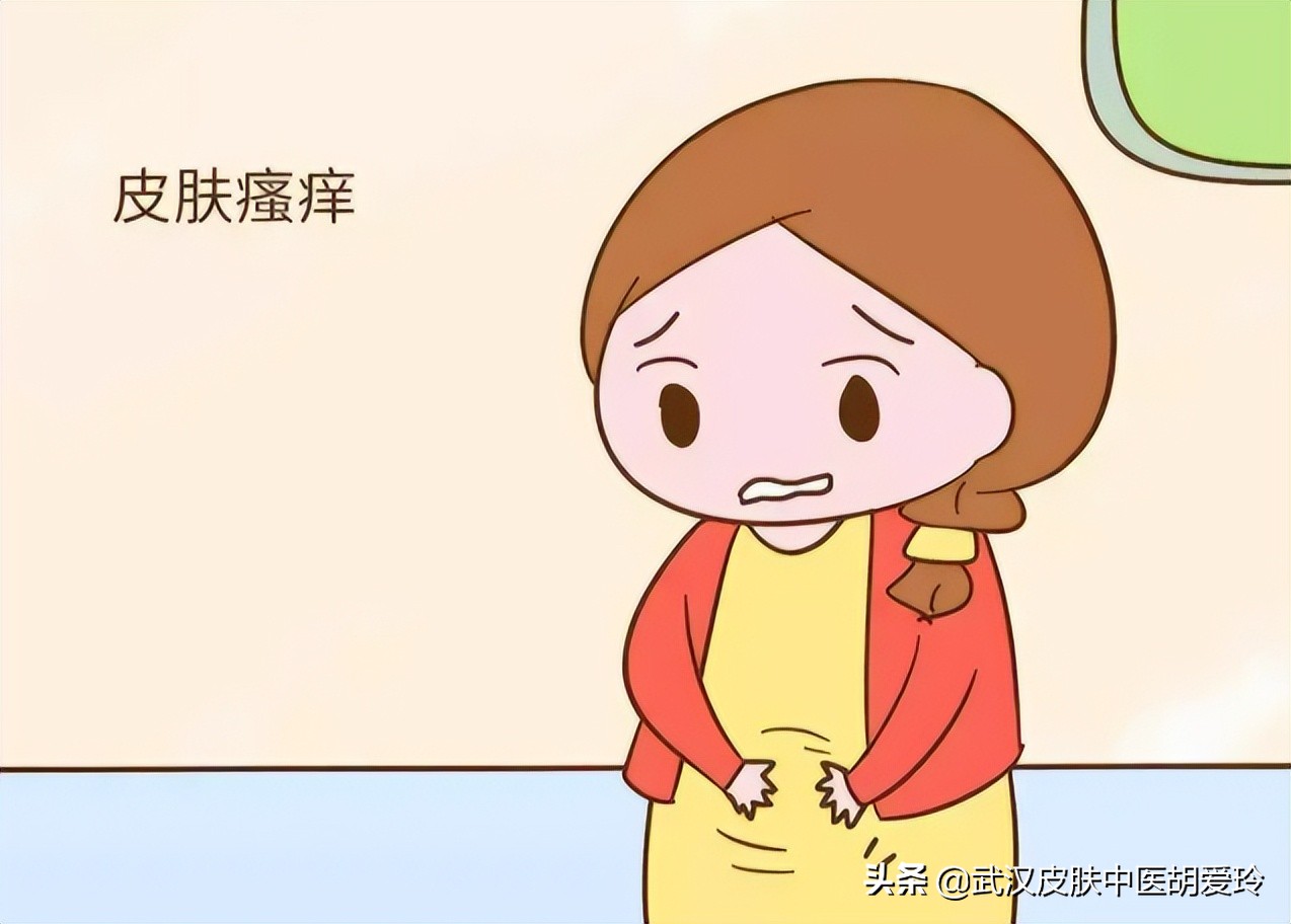 下面瘙痒最快的止痒办法可以涂什么药