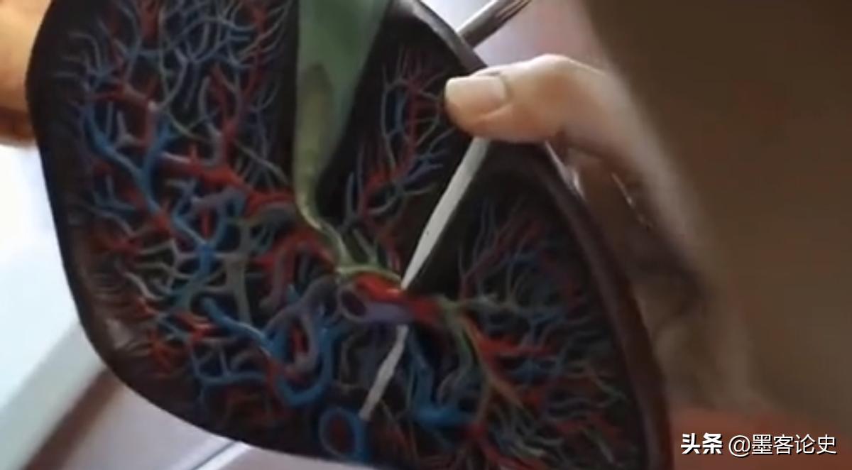 癌症晚期内蒙古小伙,53岁大叔肝肿瘤