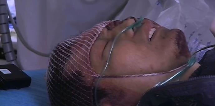 28岁工人被砸到脑袋后续,28岁工人被砸中脑袋