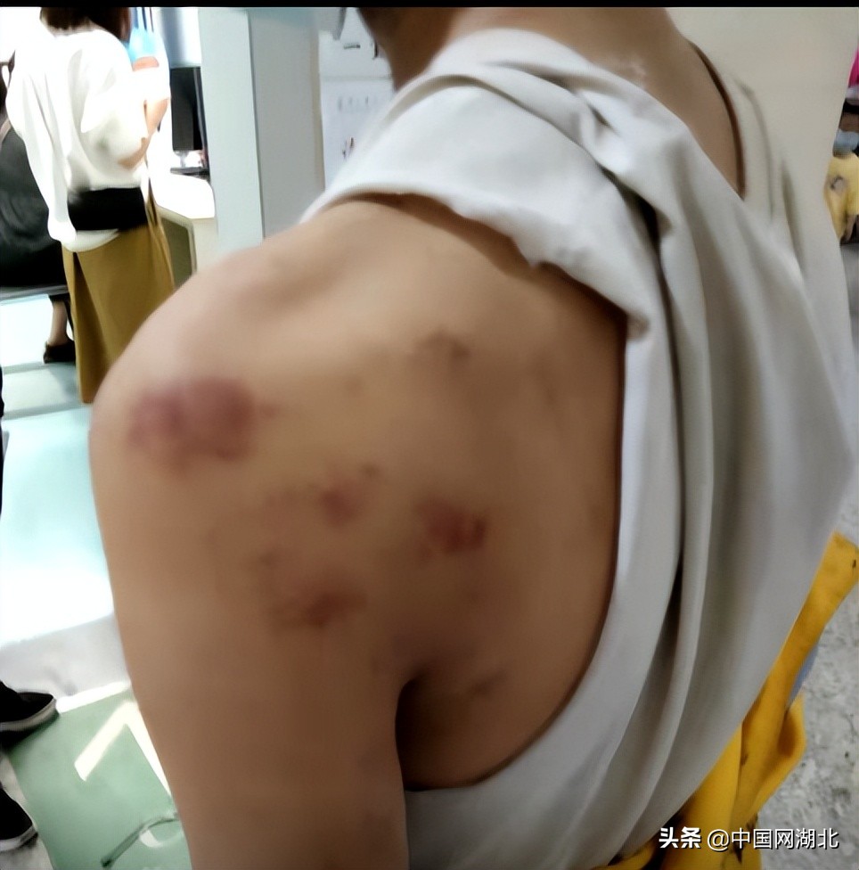 校园霸凌抽皮带,学生被霸凌三年校方回应