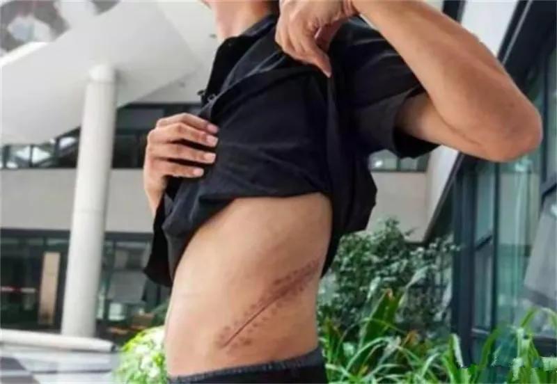 10年前卖肾买苹果手机的高三学生，获赔147万，如今肠子都悔青了