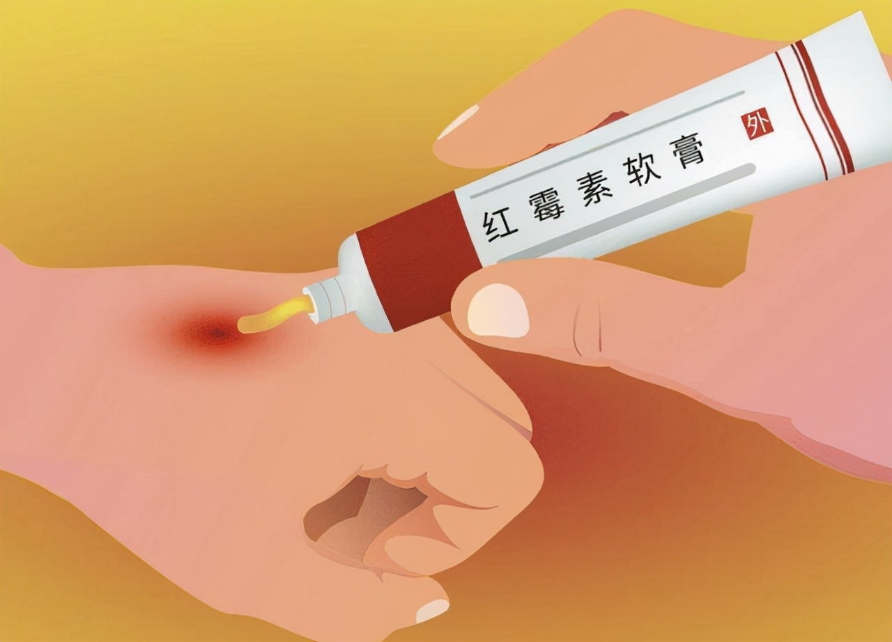 药店最便宜的药营业员不会告诉你,药店很少推荐的16种金牌药