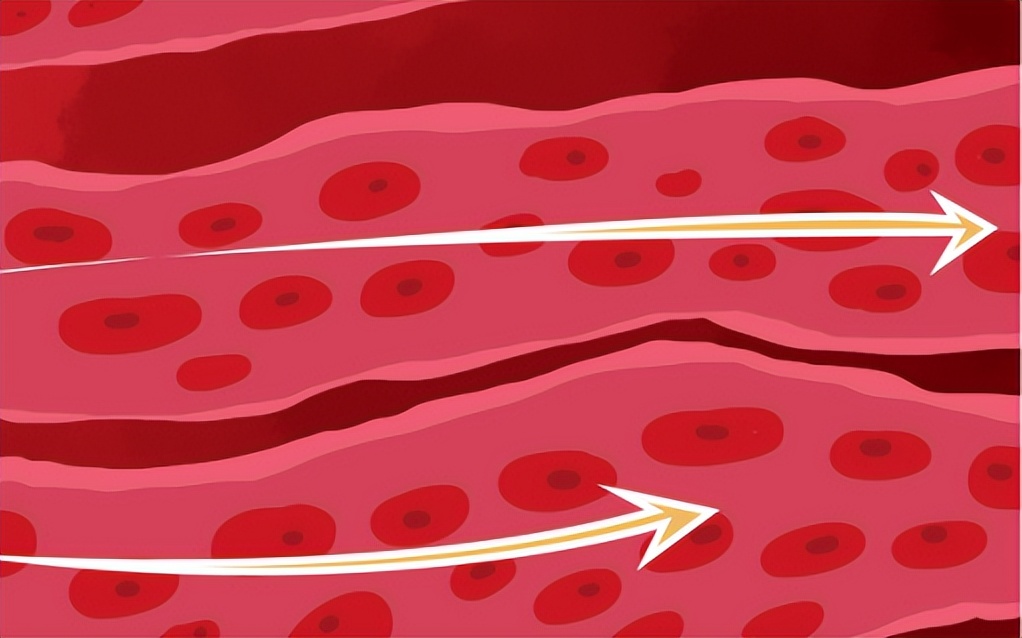 对于银屑病治疗，中医表现可一点不差！