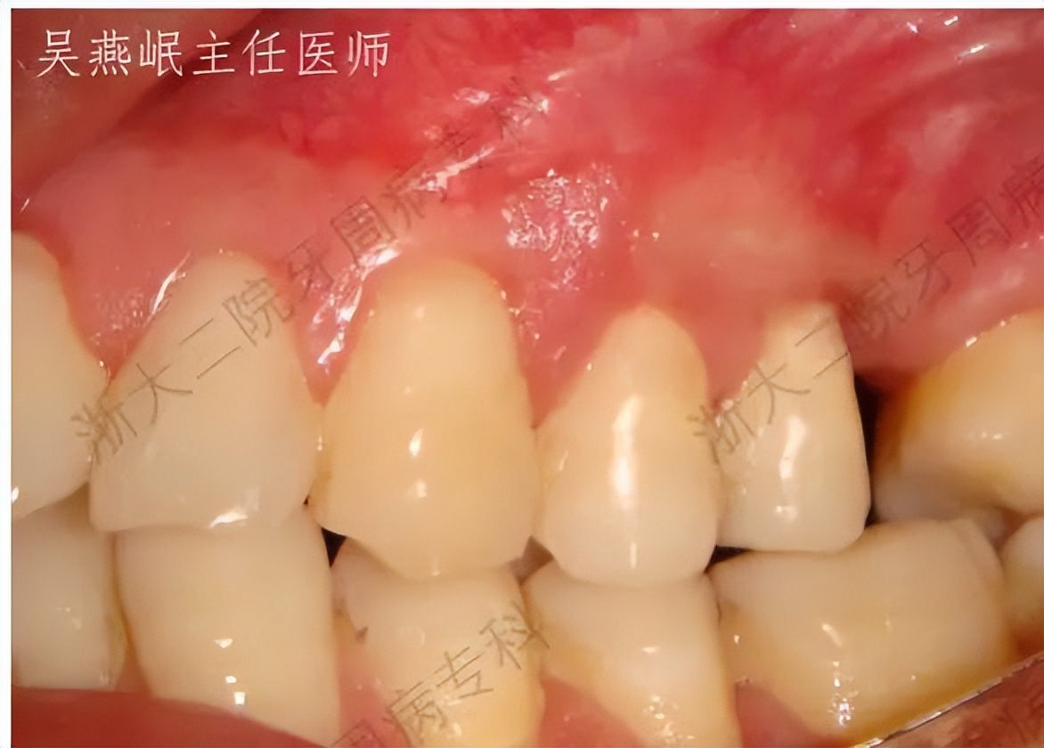 怎么拯救脱发小仙女,如何拯救牙齿上的黑洞