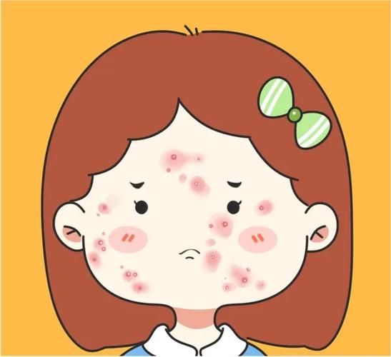 对脸上痘印消除特别有效的方法,痘印和痘坑用什么方法彻底祛除