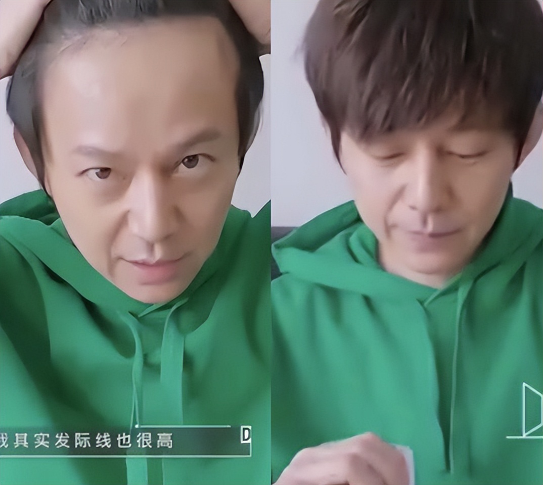 周杰伦黄晓明沙溢吴彦祖聂远,黄晓明周杰伦头发稀疏