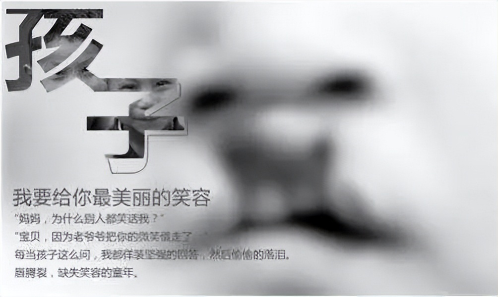 上海韦敏医生,唇腭裂基因检测的目的和意义