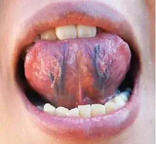 益母草调理月经很有效吗,益母草中药调经药方