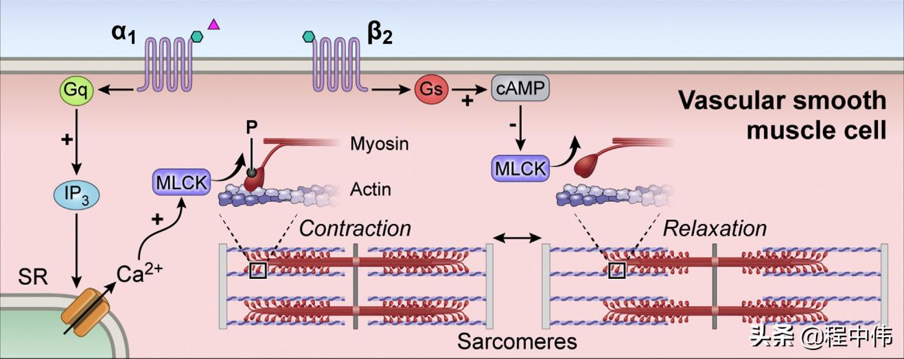 嗜铬细胞瘤出现心慌会长多大,嗜铬细胞瘤心动过速的原因