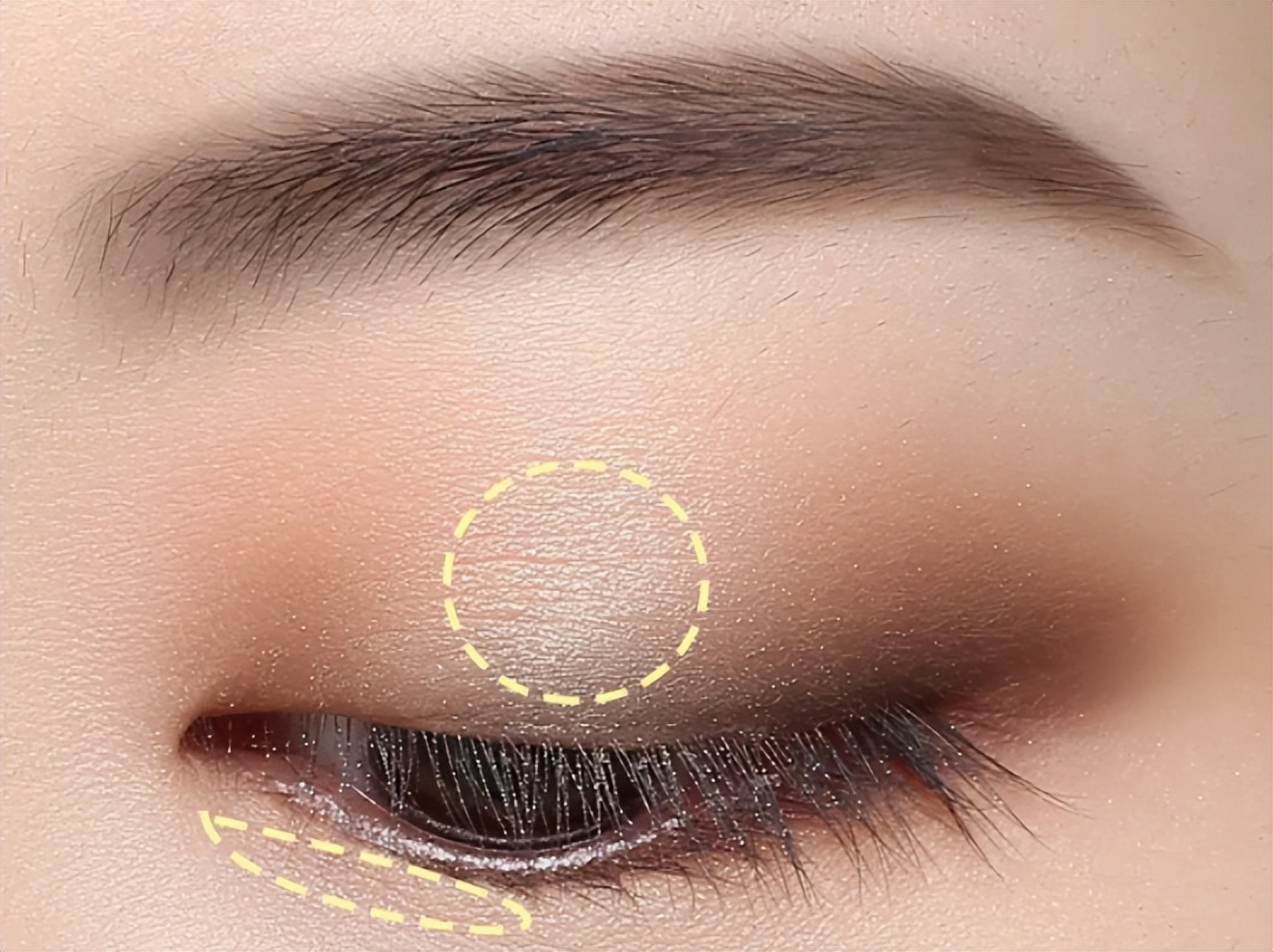 单眼皮肿眼泡如何不贴双眼皮消肿,单眼皮肿眼泡怎么消肿最快