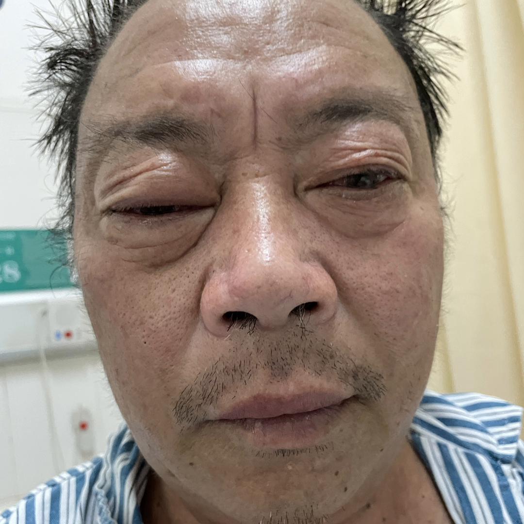 治了半年病好了怎么表达,怎么形容有病到康复的过程