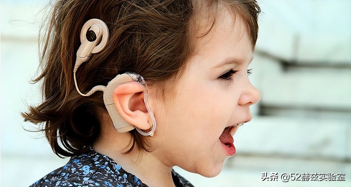 人工耳蜗进口最贵多少钱,进口人工耳蜗价格表