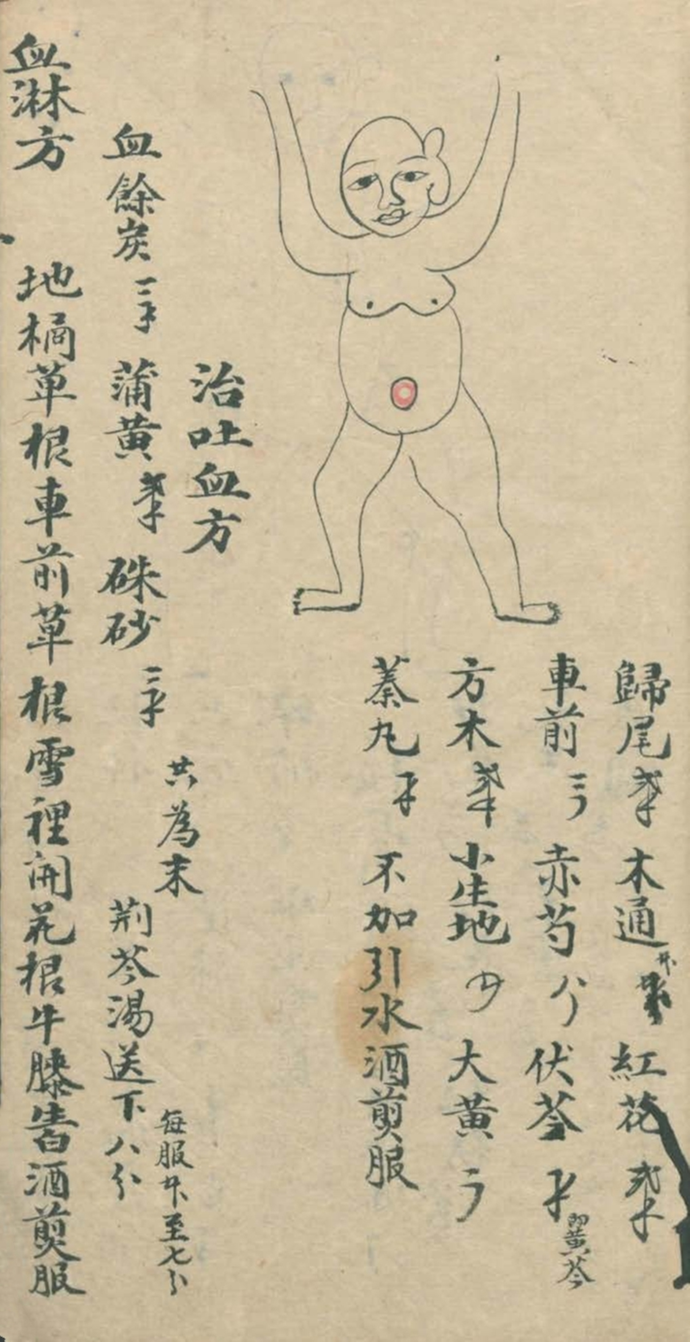 武当秘传跌打八法,民间中医古籍手抄本专医跌打秘方