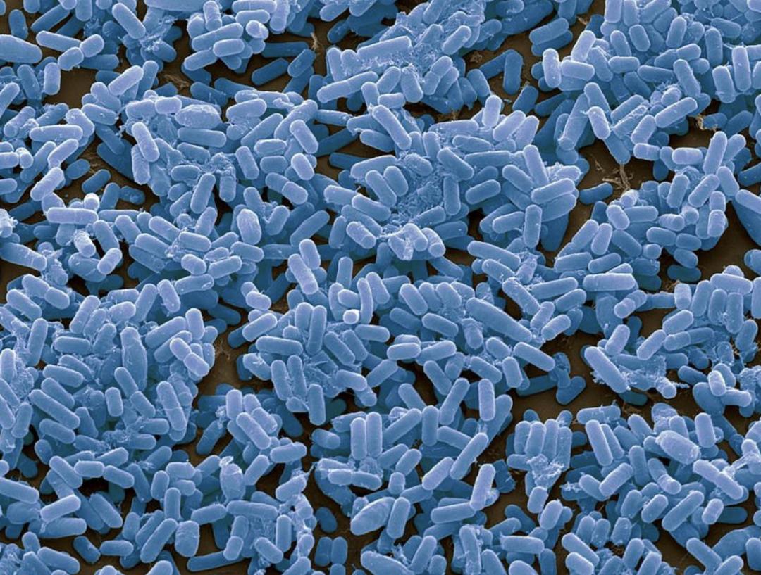 芽孢杆菌被你忽视的益生菌之王,芽孢杆菌抑制有害菌