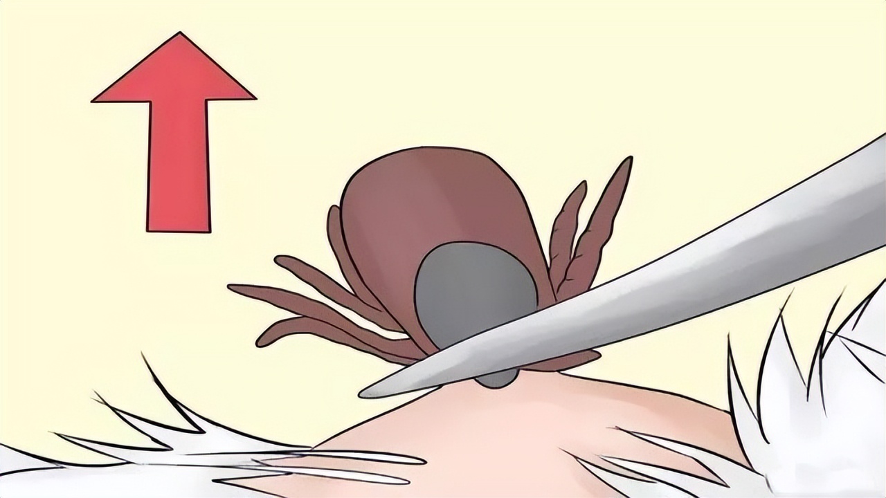 阴虱是个人的毛病吗,阴虱的源头是哪里来的怎么治