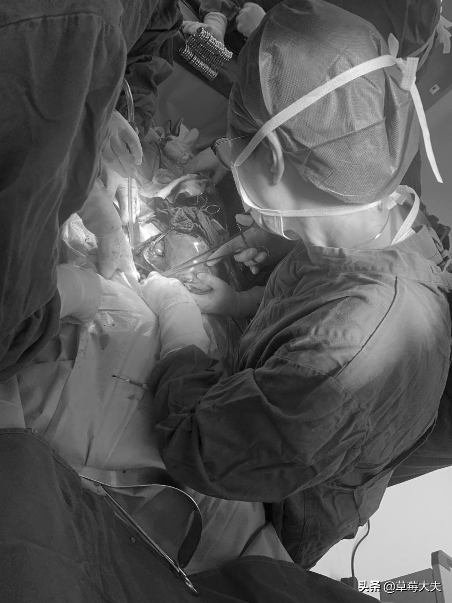 肚子莫名长大！40岁姐姐取出柚子大肿瘤，一查是肠道癌症跑到卵巢