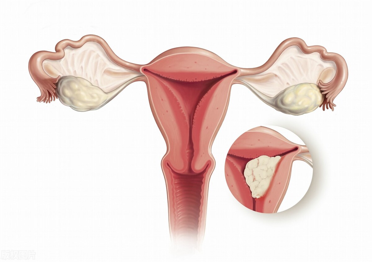 女的外阴突然肥大怎么回事,外阴肥大会造成什么后果