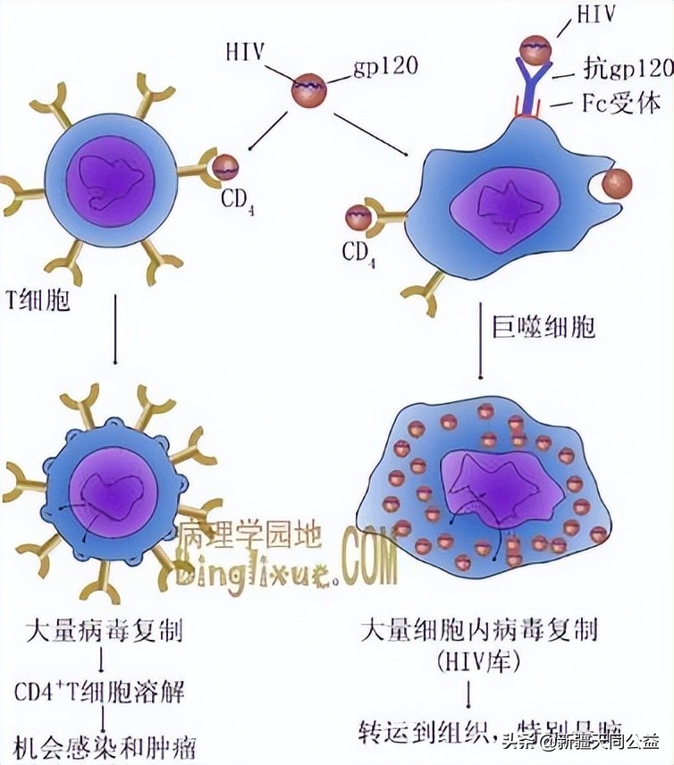 女子一人得了艾滋病感染了全家,艾滋病发病期症状的自述100例