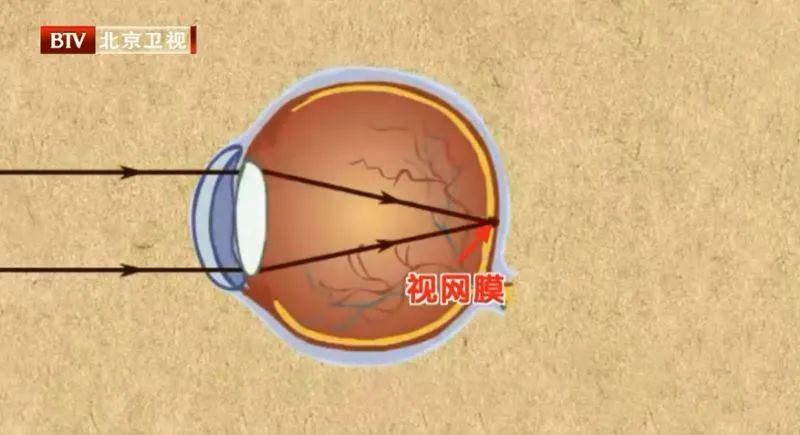 玩手机玩多了失明前兆,男子熬夜玩手机数小时差点失明