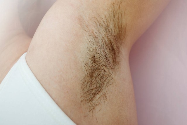 女生体毛多该不该刮掉,女生体毛多怎么办去除体毛有妙招